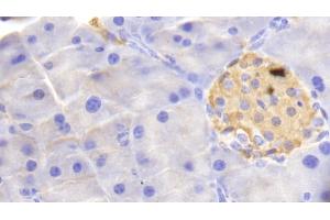 Detection of HBb in Mouse Pancreas Tissue using Polyclonal Antibody to Hemoglobin Beta (HBb) (Hemoglobin Subunit beta Antikörper  (AA 1-147))