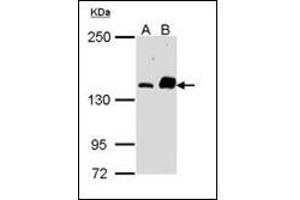Sample (30 µg of whole cell lysate). (CARD11 Antikörper)