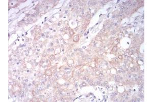 Immunohistochemistry (IHC) image for anti-Low Density Lipoprotein Receptor-Related Protein 1 (LRP1) (AA 20-155) antibody (ABIN5542496)