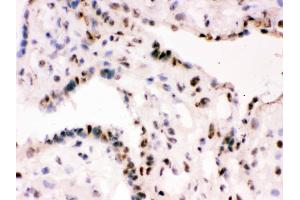 IHC analysis of RbAp48 using anti-RbAp48 antibody . (Retinoblastoma Binding Protein 4 Antikörper  (C-Term))