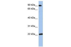 TMED10 antibody used at 1 ug/ml to detect target protein. (TMED10 Antikörper)