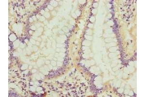 Immunohistochemistry of paraffin-embedded human small intestine tissue using ABIN7158182 at dilution of 1:100 (LRRC42 Antikörper  (AA 201-428))
