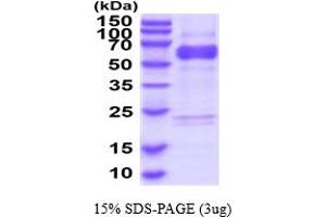 SDS-PAGE (SDS) image for ADAM Metallopeptidase Domain 10 (ADAM10) (AA 214-672) protein (His tag) (ABIN6387898) (ADAM10 Protein (AA 214-672) (His tag))