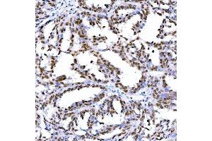 IHC analysis of STAG2 using anti-STAG2 antibody (ABIN7602420).