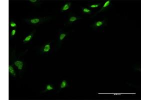 Immunofluorescence of monoclonal antibody to UBE2E3 on HeLa cell. (UBE2E3 Antikörper  (AA 65-152))