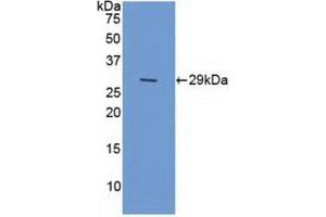 Detection of Recombinant XPG, Human using Polyclonal Antibody to Xeroderma Pigmentosum, Complementation Group G (XPG) (ERCC5 Antikörper  (AA 778-986))