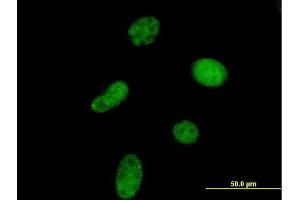 Immunofluorescence of purified MaxPab antibody to UCKL1 on HeLa cell.