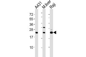 All lanes : Anti-PSMB9 Antibody (C-term) at 1:2000 dilution Lane 1: A431 whole cell lysates Lane 2: mouse liver lysates Lane 3: Raji whole cell lysates Lysates/proteins at 20 μg per lane. (PSMB9 Antikörper  (C-Term))