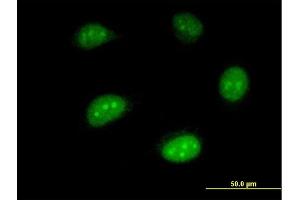 Immunofluorescence of monoclonal antibody to ISG20 on HeLa cell. (ISG20 Antikörper  (AA 1-181))