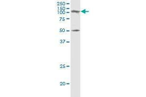 SAGE1 monoclonal antibody (M02), clone 5C1. (SAGE1 Antikörper  (AA 357-455))