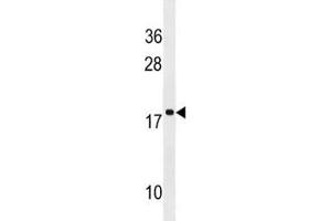 RPS17L antibody western blot analysis in NCI-H292 lysate. (RPS17L Antikörper  (AA 77-103))