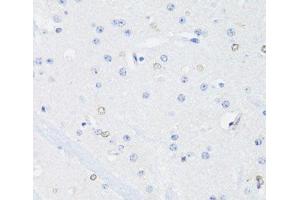 Immunohistochemistry of paraffin-embedded Mouse brain using SS18L1 Polyclonal Antibody at dilution of 1:100 (40x lens). (SS18L1 Antikörper)