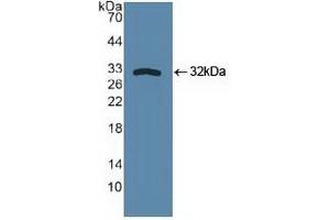 Detection of Recombinant SPHK1, Human using Polyclonal Antibody to Sphingosine Kinase 1 (SPHK1)