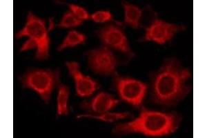 ABIN6276000 staining Hela by IF/ICC. (GPR101 Antikörper  (Internal Region))