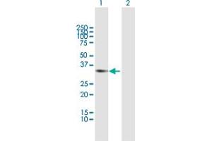 Western Blotting (WB) image for anti-Regulator of Chromosome Condensation (RCC1) and BTB (POZ) Domain Containing Protein 1 (RCBTB1) (AA 1-355) antibody (ABIN949433)