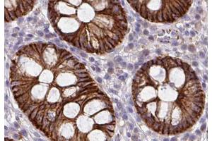Immunohistochemistry (IHC) image for anti-Junction Plakoglobin (JUP) (C-Term) antibody (ABIN6260497)