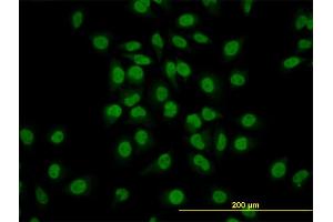 Immunofluorescence of monoclonal antibody to GATA2 on HeLa cell.