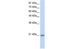 MIF4GD antibody used at 1. (MIF4GD Antikörper  (C-Term))