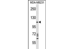 NLRC4 Antibody (N-term) (ABIN657230 and ABIN2846332) western blot analysis in MDA-M cell line lysates (35 μg/lane).