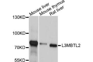 Western blot analysis of extracts of various cell lines, using L3MBTL2 antibody (ABIN5998104) at 1/1000 dilution. (L3MBTL2 Antikörper)