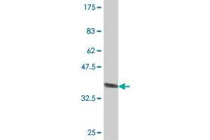 Western Blot detection against Immunogen (36. (ABCA6 Antikörper  (AA 53-149))