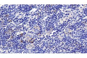 Immunohistochemistry (IHC) image for anti-Ribonuclease, RNase A Family, 2 (Liver, Eosinophil-Derived Neurotoxin) (RNASE2) (AA 26-155) antibody (ABIN7445738)