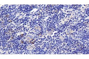 Detection of RNASE2 in Rat Spleen Tissue using Polyclonal Antibody to Ribonuclease A2 (RNASE2)