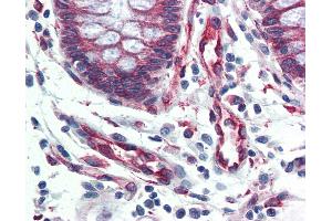 Anti-SERPINH1 / HSP47 antibody IHC of human colon.