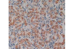 Used in DAB staining on fromalin fixed paraffin- embedded stomach tissue (Neurotrophin 4 Antikörper  (AA 81-210))