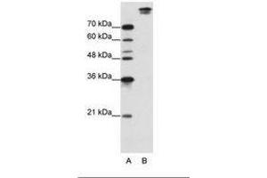 Image no. 1 for anti-Pre-mRNA Branch Site Protein p14 (SF3B14) (AA 131-180) antibody (ABIN203254) (Pre-mRNA Branch Site Protein p14 (SF3B14) (AA 131-180) Antikörper)