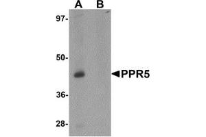 Western blot analysis of PRR5 in SK-N-SH cell lysate with PRR5 antibody at 1 μg/ml in (A) the absence and (B) the presence of blocking peptide