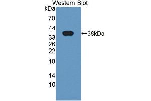 Western blot analysis of the recombinant protein. (LASP1 Antikörper  (AA 1-261))