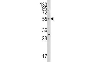 Western blot analysis of TRF1 antibody and Jurkat lysate (TRF1 Antikörper  (AA 337-366))