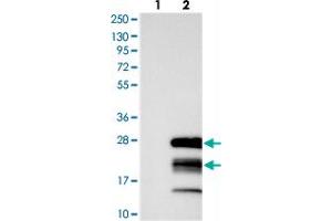 Western blot analysis of Lane 1: Negative control (vector only transfected HEK293T lysate), Lane 2: Over-expression Lysate (Co-expressed with a C-terminal myc-DDK tag (~3. (GTSF1 Antikörper)