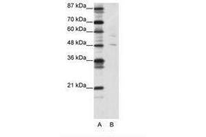 Image no. 1 for anti-Pleiomorphic Adenoma Gene-Like 1 (PLAGL1) (N-Term) antibody (ABIN202463) (PLAGL1 Antikörper  (N-Term))