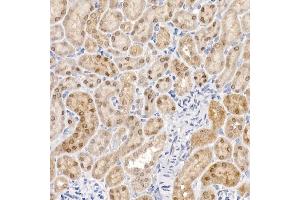 Immunohistochemistry of paraffin-embedded mouse kidney using PCBD1 Rabbit mAb (ABIN7269743) at dilution of 1:150 (40x lens).
