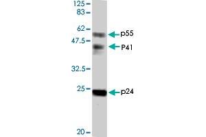 Detection of HIV-1 p24 and precursor proteins p55 and p41 by Western blotting using the HIV-1 Gag p24 polyclonal antibody  .