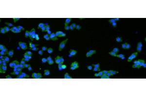 Immunofluorescence analysIs ofNCCIT cell using VMA21 Polyclonal Antibody at dilution of 1:50 (VMA21 Antikörper)