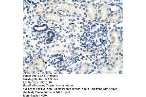 Rabbit Anti-DDX17 Antibody  Paraffin Embedded Tissue: Human Kidney Cellular Data: Epithelial cells of renal tubule Antibody Concentration: 4. (DDX17 Antikörper  (N-Term))