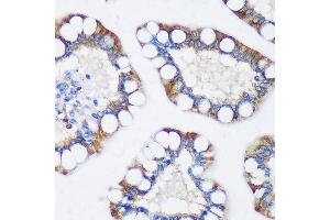 Immunohistochemistry of paraffin-embedded Human colon using TRIM62 Rabbit pAb (ABIN7270996) at dilution of 1:100 (40x lens). (TRIM62 Antikörper  (AA 120-280))