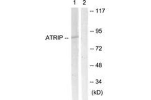 Western blot analysis of extracts from NIH-3T3 cells, using ATRIP (Ab-68/72) Antibody.