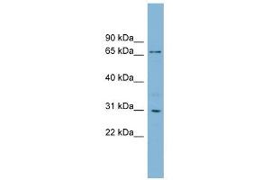 TBCCD1 antibody used at 1 ug/ml to detect target protein. (TBCCD1 Antikörper  (N-Term))