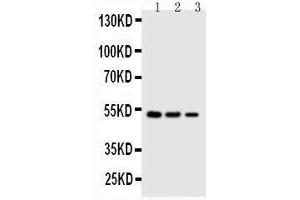 Anti-Kallistatin antibody, Western blotting Lane 1: SMMC Cell Lysate Lane 2: COLO320 Cell Lysate Lane 3: JURKAT Cell Lysate (SERPINA4 Antikörper  (C-Term))
