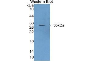 Detection of Recombinant PTTG1, Mouse using Polyclonal Antibody to Pituitary Tumor Transforming 1 (PTTG1) (PTTG1 Antikörper  (AA 2-199))