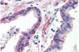 Human Prostate (formalin-fixed, paraffin-embedded) stained with ITGB1 antibody ABIN364255 at 10 ug/ml followed by biotinylated anti-mouse IgG secondary antibody ABIN481714, alkaline phosphatase-streptavidin and chromogen. (ITGB1 Antikörper)