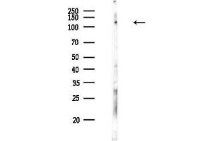 anti-Aldehyde Oxidase 1 (AOX1) (Internal Region) antibody