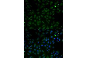 Immunofluorescence analysis of HeLa cells using VDAC1 antibody. (VDAC1 Antikörper)