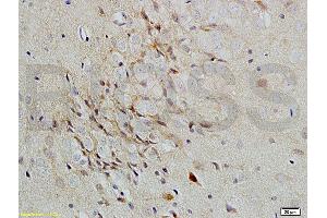 Formalin-fixed and paraffin-embedded rat brain labeled with Rabbit Anti-Versican Polyclonal Antibody, Unconjugated (ABIN741660) 1:200 followed by conjugation to the secondary antibody and DAB staining