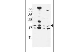 Western blot analysis in MCF-7,NCI-H460,HepG2,Hela cell line lysates (35ug/lane). (CNPY2/MSAP Antikörper  (C-Term))
