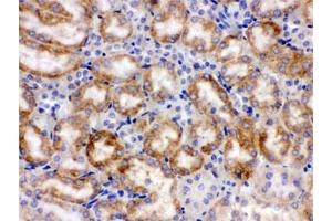 Immunohistochemistry (IHC) image for anti-Cytochrome P450, Family 1, Subfamily A, Polypeptide 1 (CYP1A1) (AA 183-320) antibody (ABIN4950722)